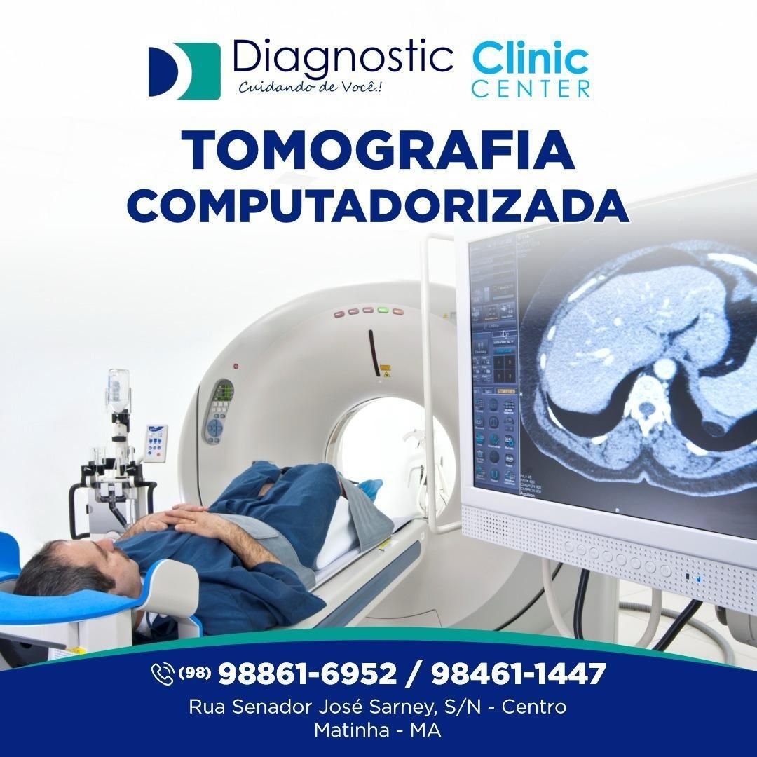 Tomógrafo de Alta Resolução – Diagnostic Clinic Center